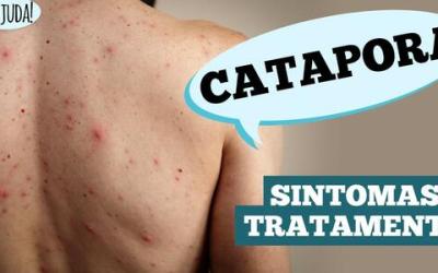 Catapora: sintomas, complicações e prevenção